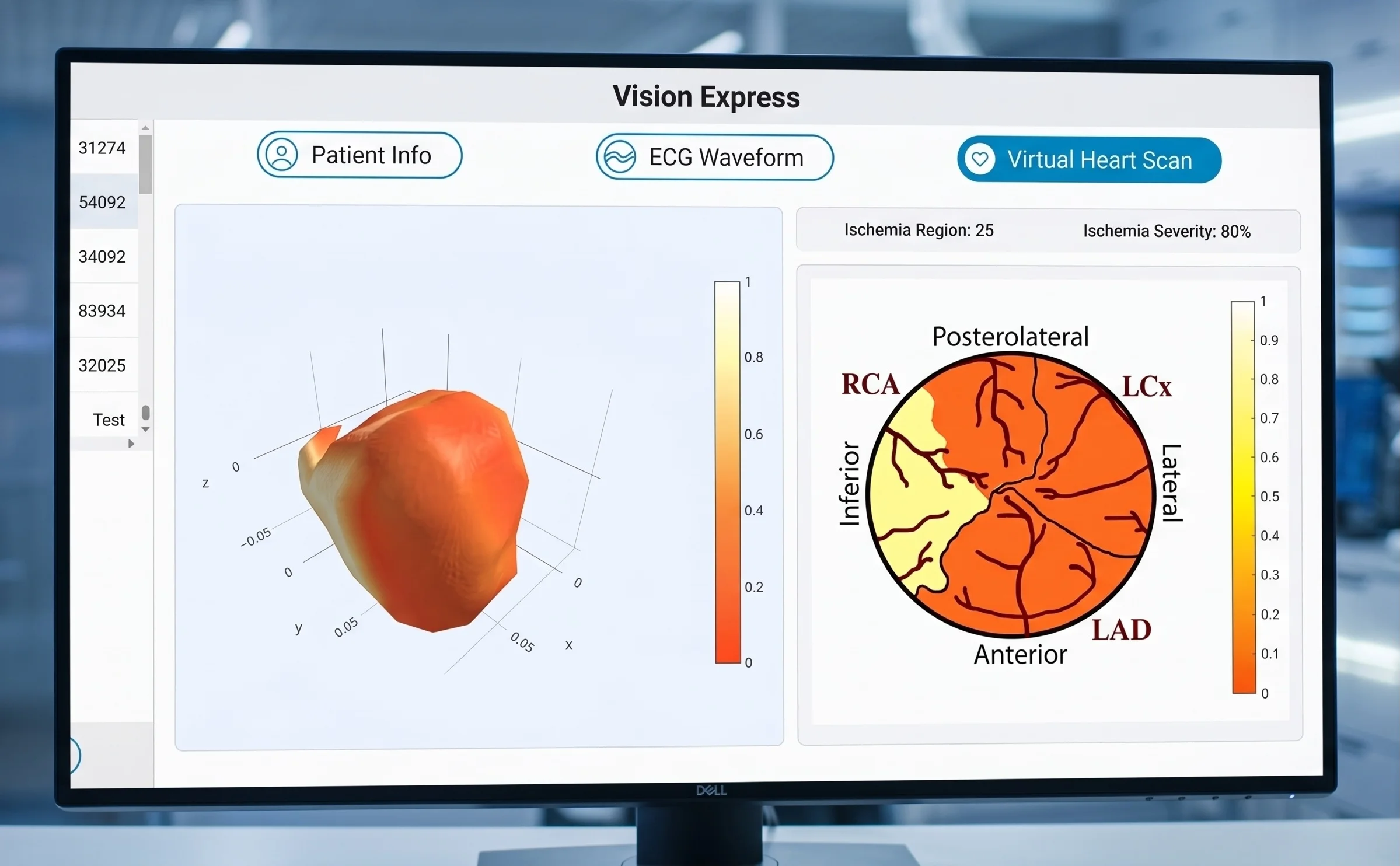 CardiGemini Vision Express software UI